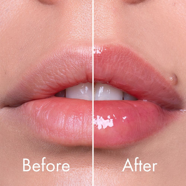 Плампер для губ со спикулами интенсивный VT Cosmetics Reedle Shot Lip Plumper Expert, 4.3 г 3709 фото